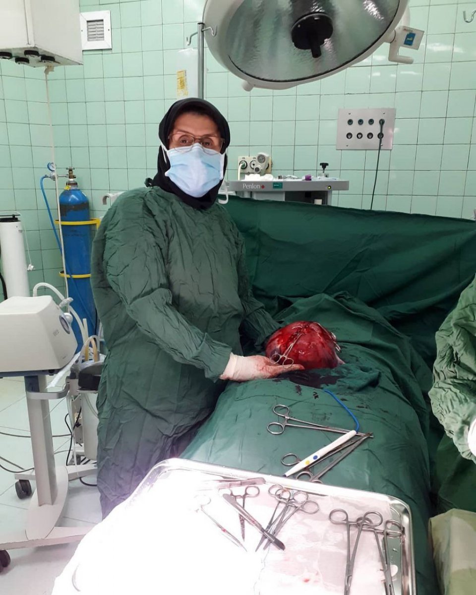 هیسترکتومی یا برداشتن رحم مربوط به یک خانم ۵۲ ساله